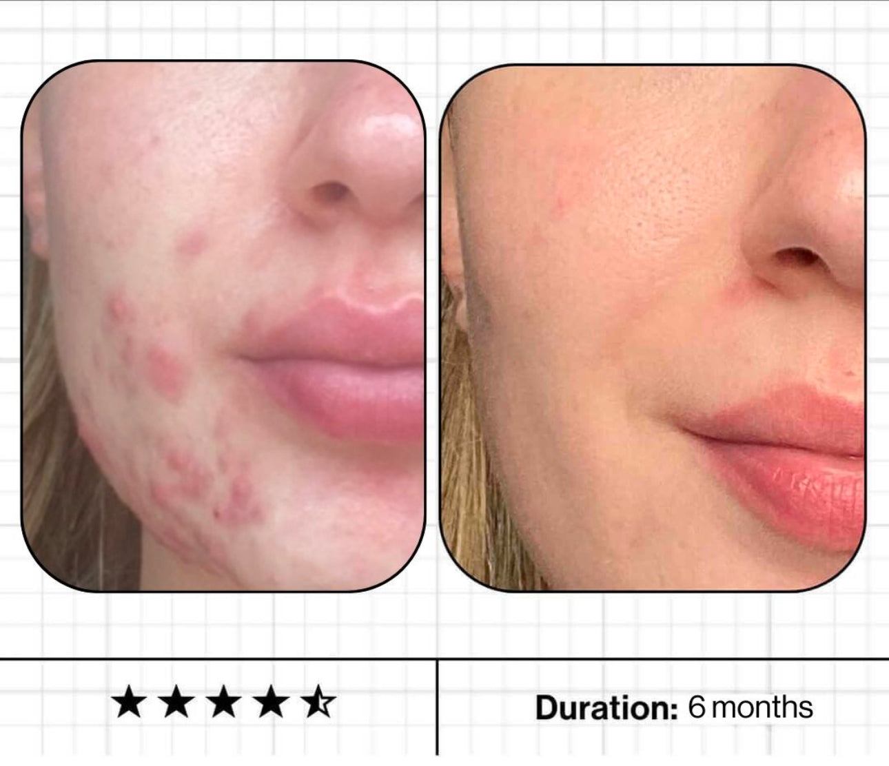 Skin Accumax™